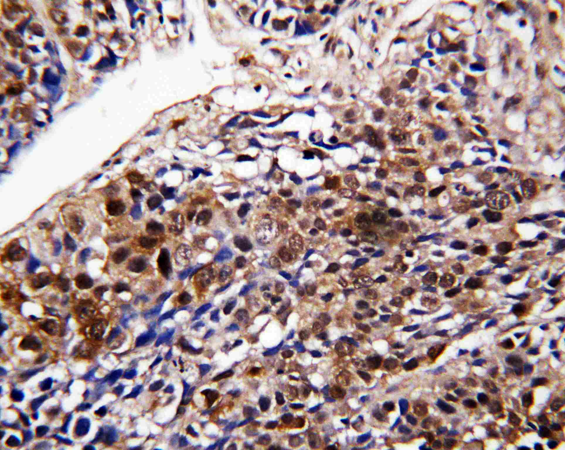 Polyclonal Rabbit anti-Human DDT / Dopamine Tautomerase Antibody (aa99-118, IHC, WB)