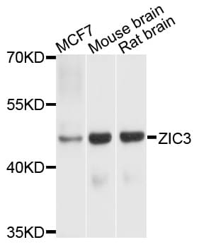Polyclonal Rabbit anti-Human ZIC3 Antibody (WB)