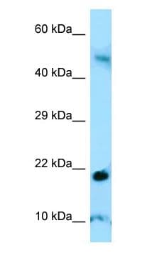 AMELY Antibody (C-Terminus)