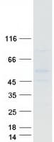 Human GPR150 Protein (Recombinant Myc-DDK (Flag))