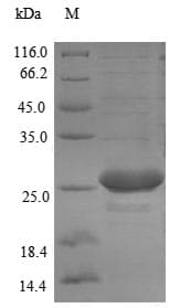 Yersinia pseudotuberculosis yscM Protein (Recombinant 6His-SUMO, N-terminus)