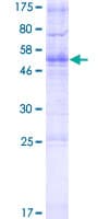 Human TMEM178 Protein (Recombinant GST)