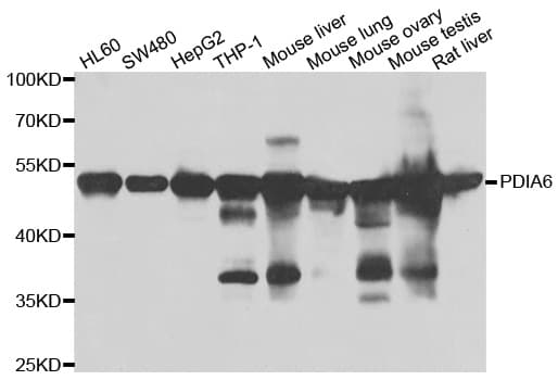 PDIA6 / ERP5 Antibody