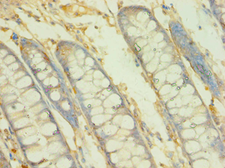 BCAT2 Antibody (aa20-200)