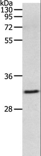 Polyclonal Rabbit anti-Human MMP26 Antibody (WB)