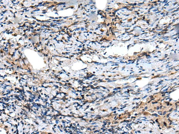Polyclonal Rabbit anti-Human CXCL6 Antibody (IHC)