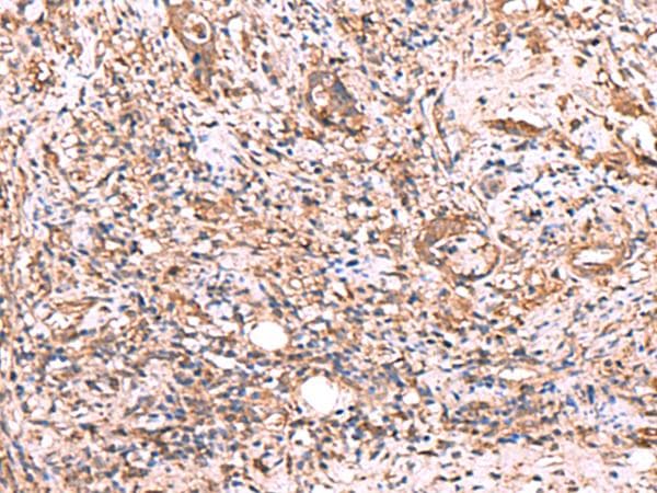 TTC38 Antibody