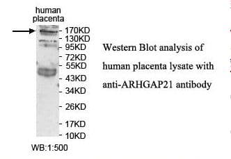 Polyclonal Rabbit anti-Human ARHGAP21 Antibody (aa10-193, IHC, WB)