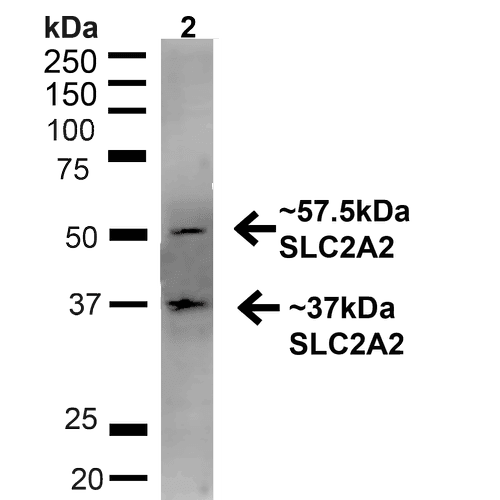 SLC2A2 / GLUT2 Antibody (Biotin)