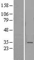 ADAL Protein (Over-Expression Lysate Myc-DDK (Flag))
