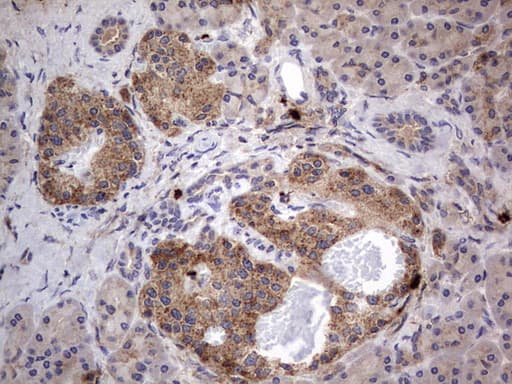 Monoclonal Mouse anti-Human SMPD1 / Acid Sphingomyelinase Antibody (clone OTI3H7, aa62-341, IHC, WB)
