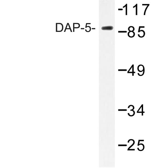 DAP-5 / EIF4G2 Antibody (Asn65)