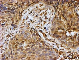 PSMB9 Antibody (aa21-219, clone OTI1D1)