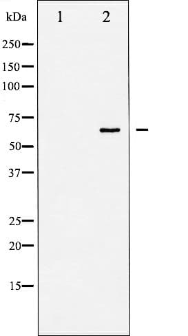 p66 / SHC Antibody (phospho-Tyr427)
