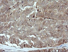 MAP2K1 / MKK1 / MEK1 Antibody (clone OTI4B1)