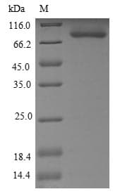 Human RECQ1 / RECQL Protein (Recombinant)