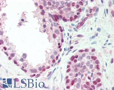 IHC-plus™ RPA2 / RFA2 / RPA34 Antibody (aa220-270)