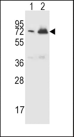 IHC-plus™ CFHR5 Antibody (aa203-231)