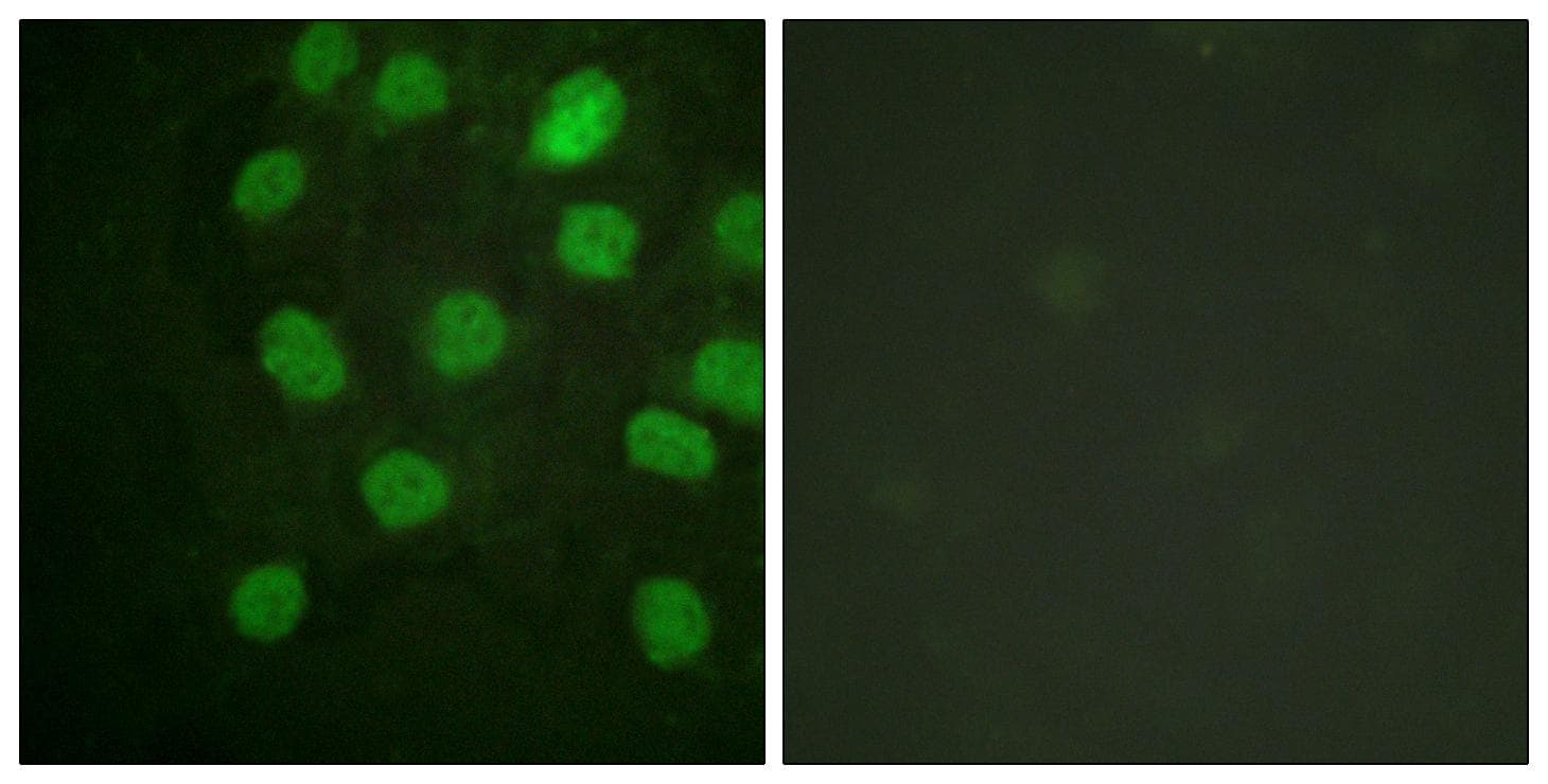 PRKDC / DNA-PKcs Antibody