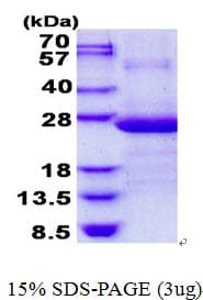 Human AP3S1 Protein (Recombinant His)