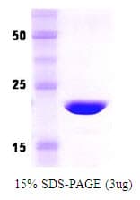 Human Recoverin Protein (Recombinant)