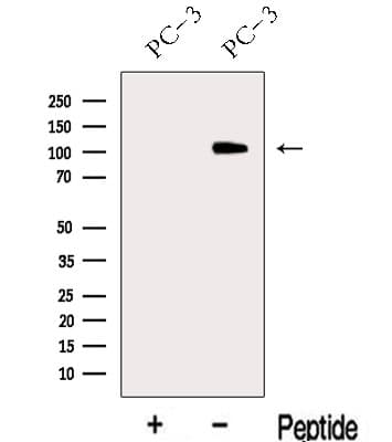 Polyclonal Rabbit anti-Human MICAL2 Antibody (WB)