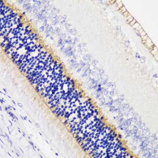 TMEM16B / ANO2 Antibody