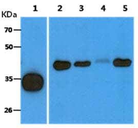 ACOT8 Antibody (clone AT4D10)