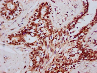 DHX38 Antibody