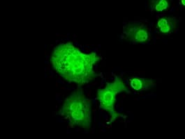 C16orf72 Antibody (clone OTI2D1)
