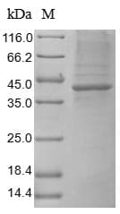 Human GUCY2C / Guanylyl Cyclase C Protein (Recombinant 10His, N-terminus)