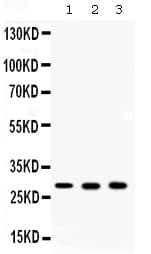 CA2 / Carbonic Anhydrase II Antibody
