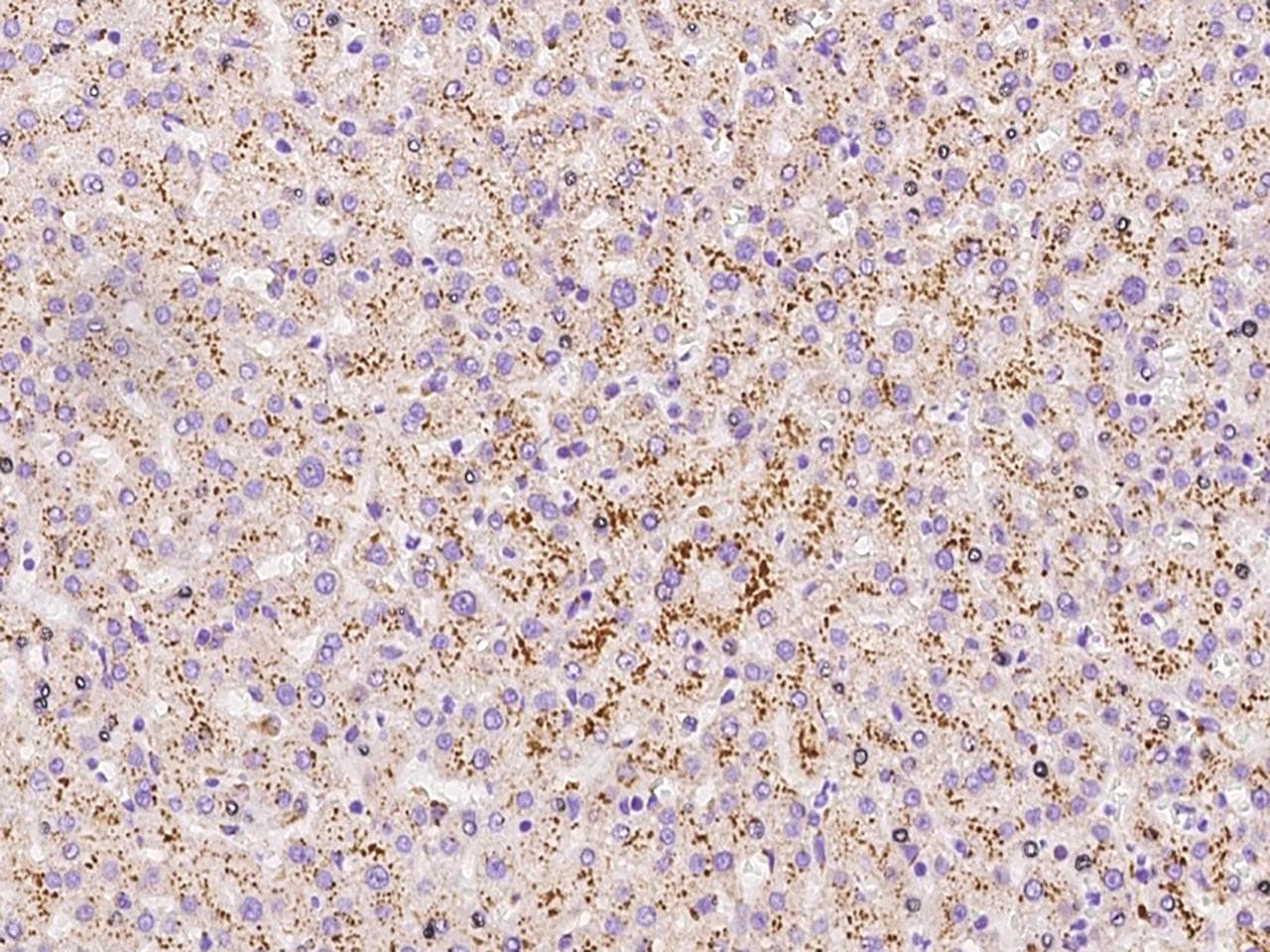 Polyclonal Rabbit anti-Human LIMPII / SCARB2 Antibody (IHC, WB)