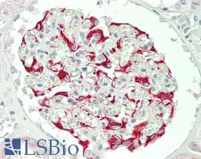IHC-plus™ UEV1 / UEV1A Antibody