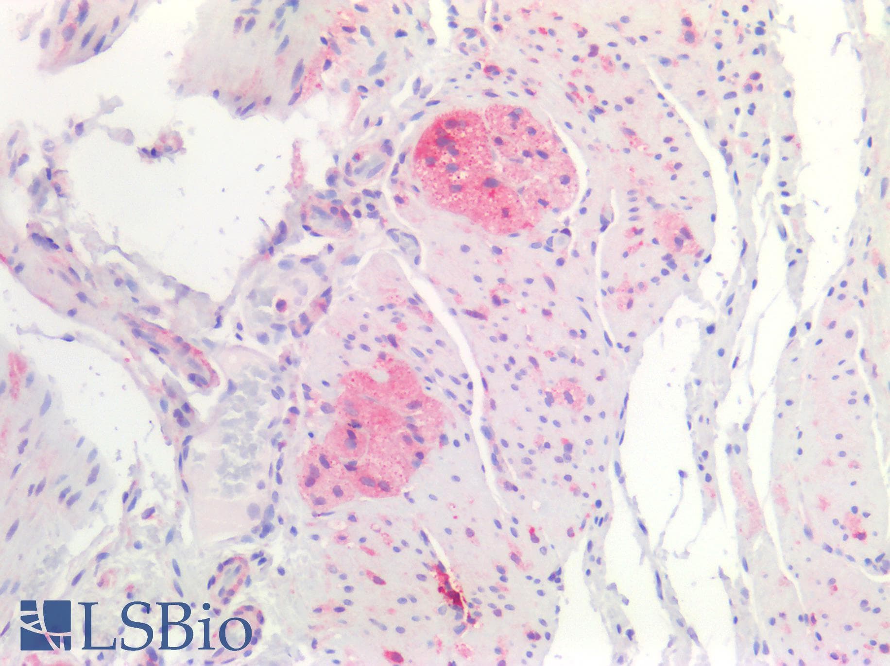 IHC-plus™ Polyclonal Rabbit anti-Human SLC6A3 / Dopamine Transporter Antibody (IHC)