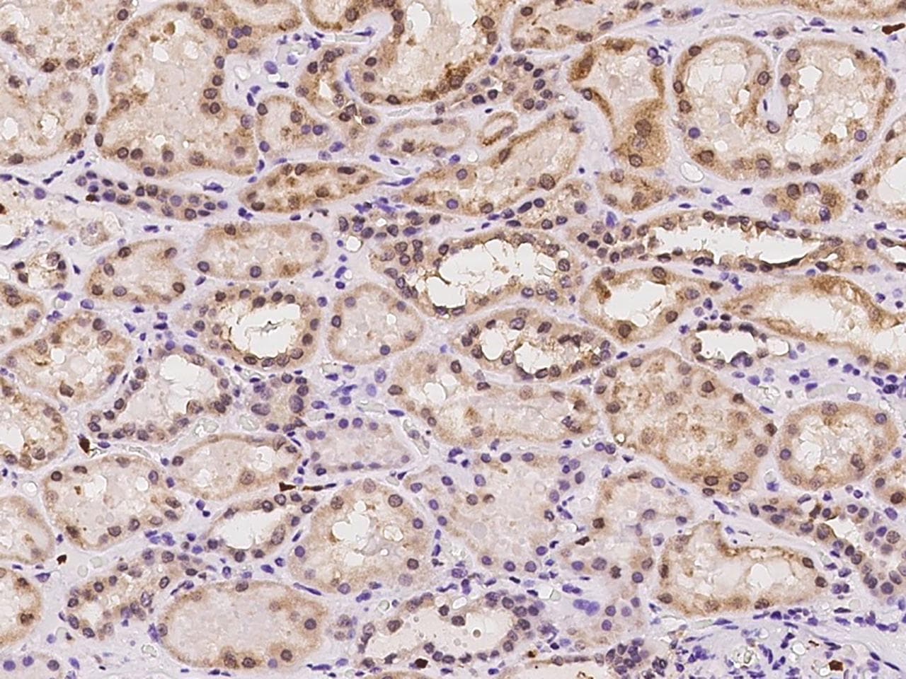 GGCX Antibody