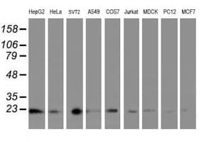 UBE2E3 Antibody (clone OTI7E8)