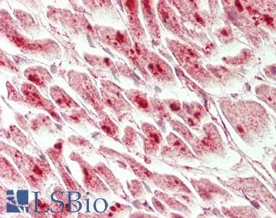 IHC-plus™ NFIB Antibody (aa225-275)