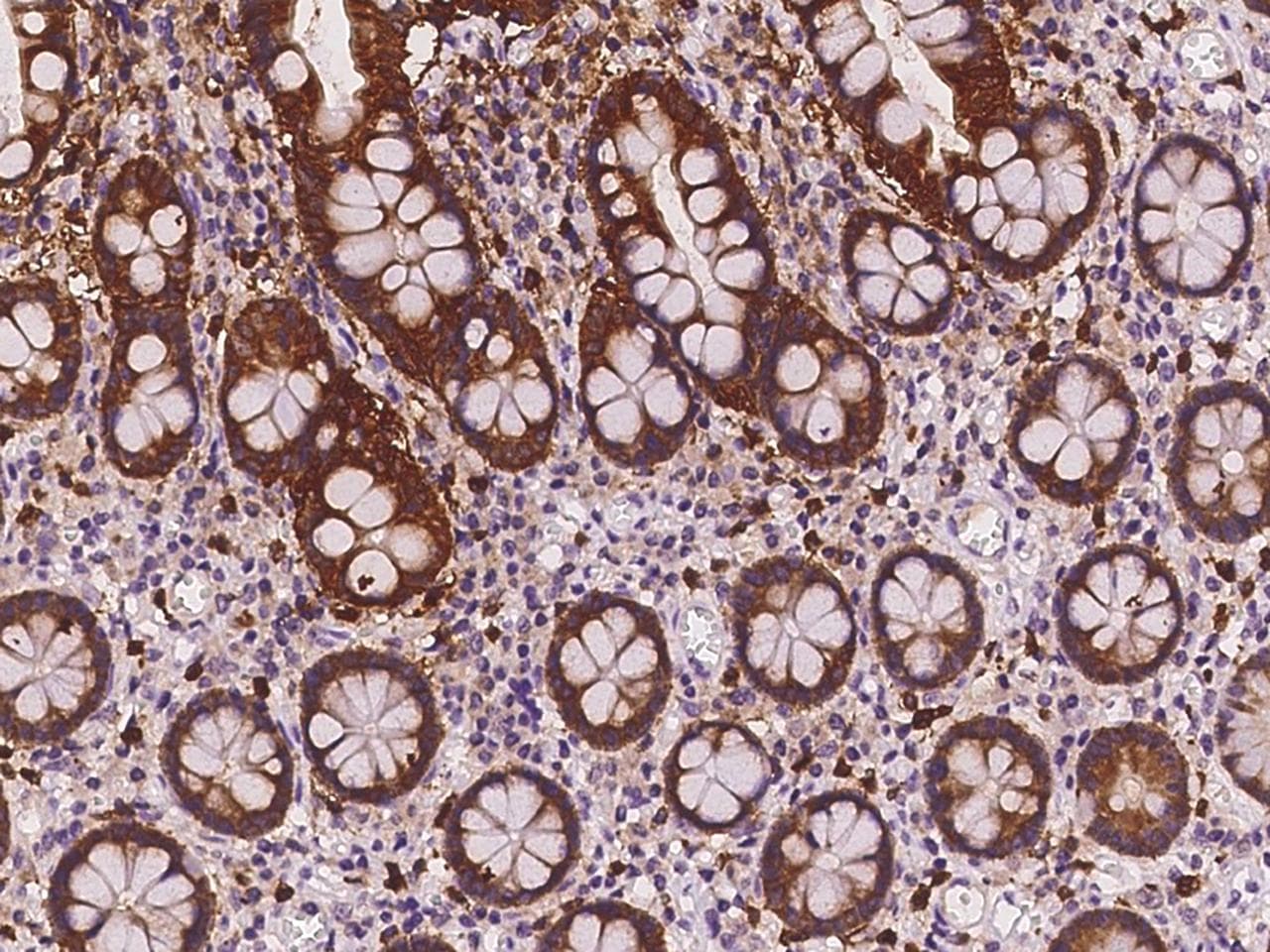 PHGR1 Antibody
