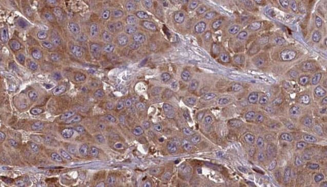 CD225 / IFITM1 Antibody