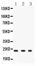GSTP1 / GST Pi Antibody (aa12-32)