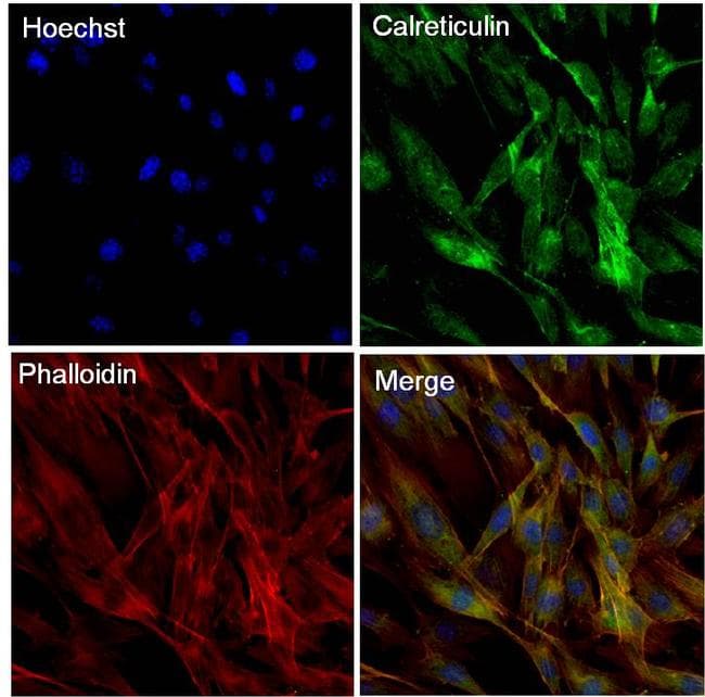Monoclonal Mouse anti-Human CALR / Calreticulin Antibody (clone 1G6A7, EEEDVPGQAKDELC, IHC, IF, WB)