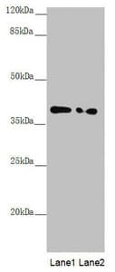 PPP1R8 / Rnase E Antibody