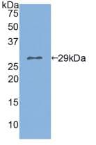 Human GOB5 / CLCA1 Protein (Recombinant His, N-Terminal)