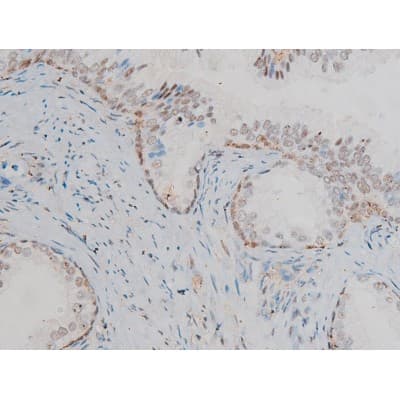 GJA1 / CX43 / Connexin 43 Antibody (phospho-Ser367)
