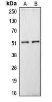 Polyclonal Rabbit anti-Human CPN1 Antibody (C-Terminus, WB)