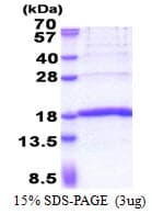 Human KHDC1L Protein (Recombinant His)