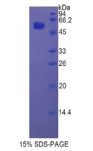 Rat GBA / Glucosidase Beta Acid Protein (Recombinant His-GST)