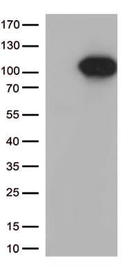 Monoclonal Mouse anti-Human FOXO3 / FOXO3A Antibody (clone OTI5F11, aa374-673, IHC, WB)