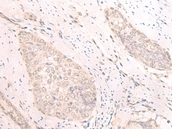 Polyclonal Rabbit anti-Human TBC1D2 Antibody (IHC)